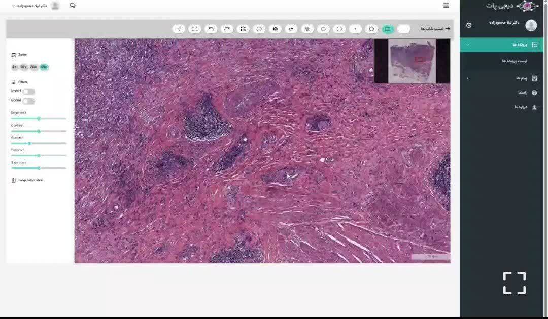 بهرهمندی از سامانه تشخیص سرطان توسط یک شرکت دانش بنیان در ارومیه بهرهمندی از سامانه تشخیص سرطان توسط یک شرکت دانش بنیان در ارومیه