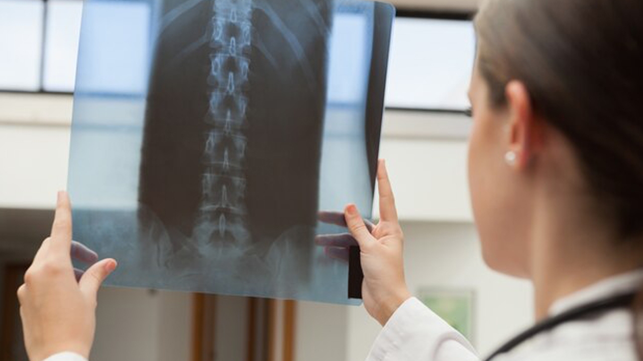 دستاورد نوین دانشمندان برای بازسازی و توقف تخریب دیسک بین‌مهره‌ای